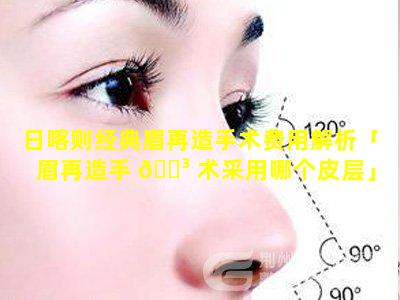 日喀则经典眉再造手术费用解析「眉再造手 🌳 术采用哪个皮层」